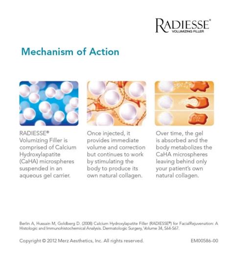 radiesse adalah|Mechanism of Action .
